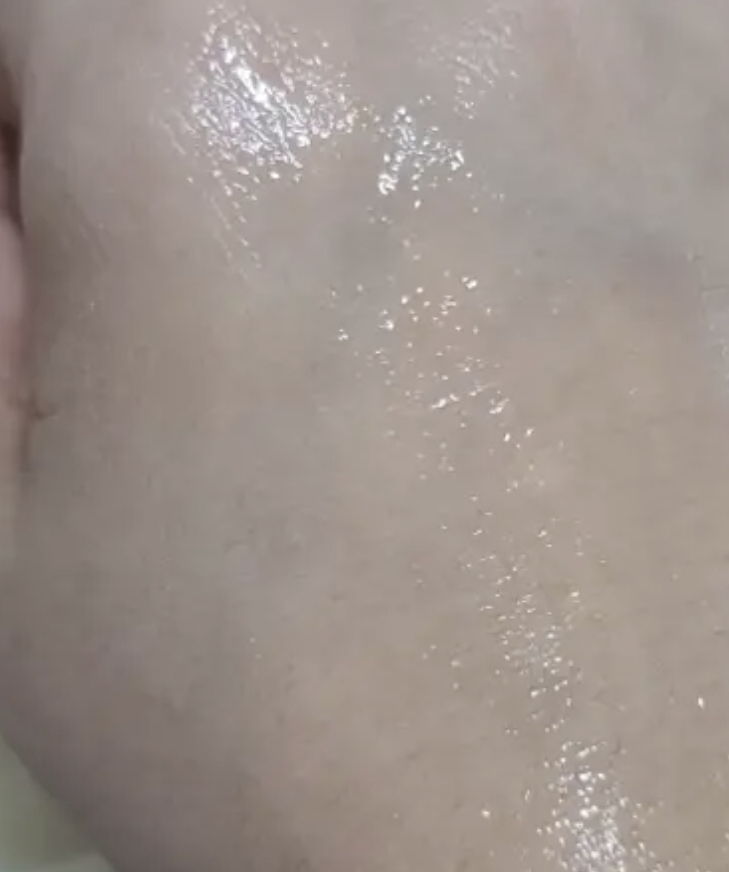 후시다인 (Fusidyne) 더마 트러블 밸런싱 세럼 review image