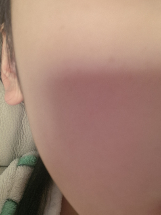 美迪惠尔 植物酶去角质垫 review image