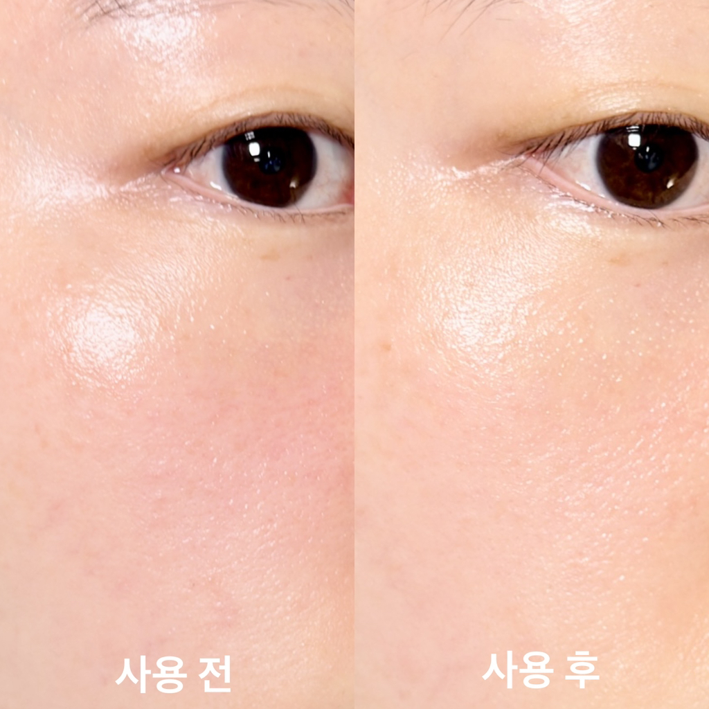 로벡틴 (ROVECTIN) 배리어 리페어 울트라 크림 review image