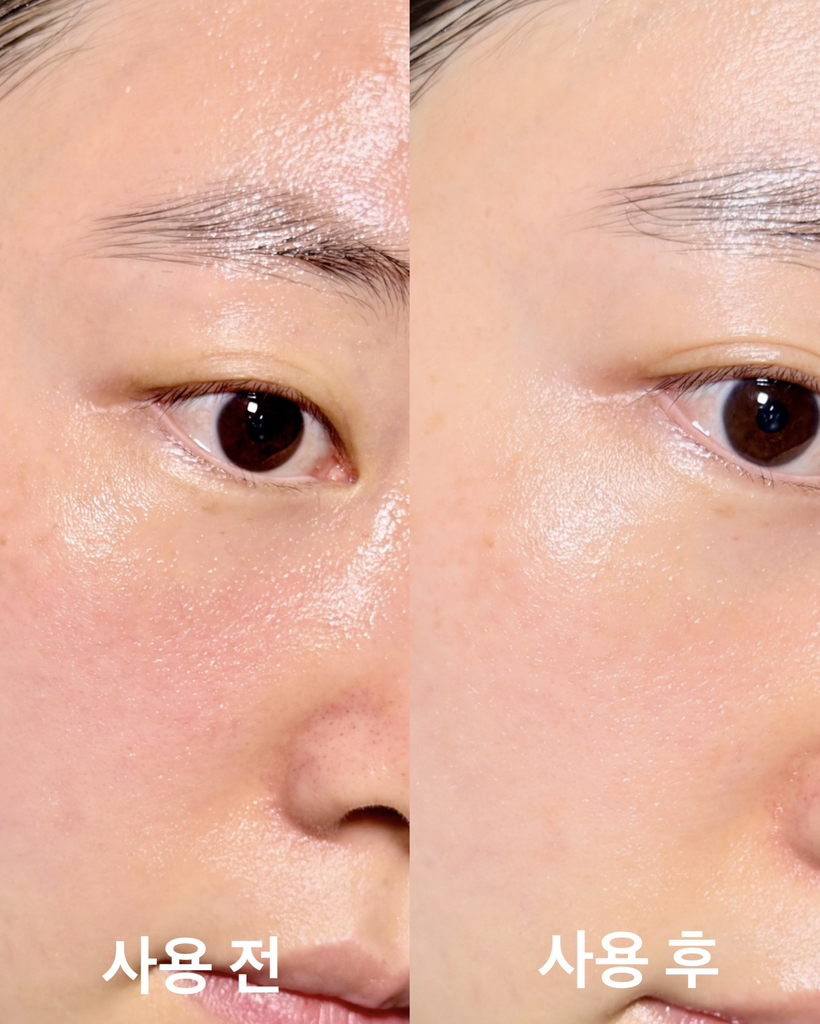 로벡틴 (ROVECTIN) 배리어 리페어 울트라 크림 review image