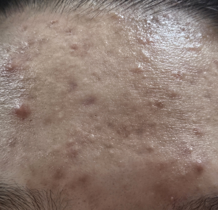 阿彼芙 鱼迹精华垫透明触感 review image