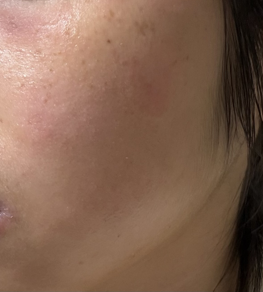 로벡틴 (ROVECTIN) 비타 다크 스팟 세럼 review image