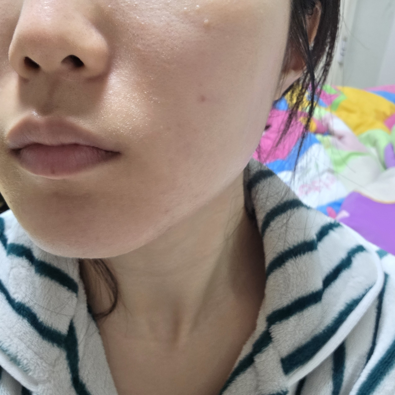 마녀공장 (manyo) 비피다 바이옴 앰플 로션 review image