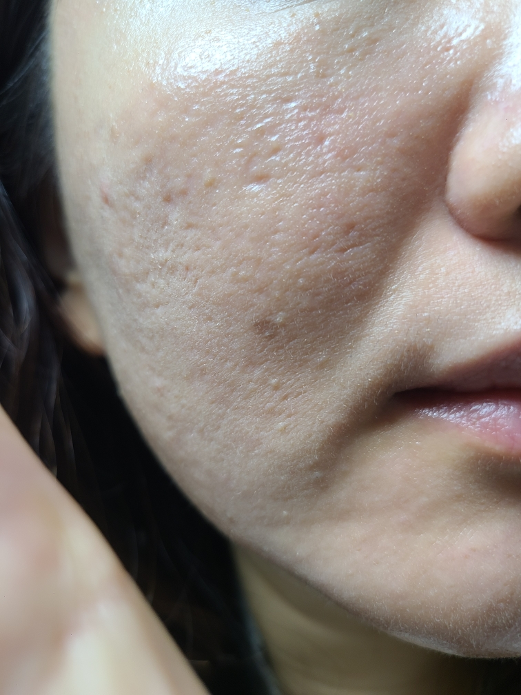 미바 (MIBA) 왕쿠션 시즌3 글로우 러블리 [SPF50+/PA++++] [21호 로지아이보리] review image