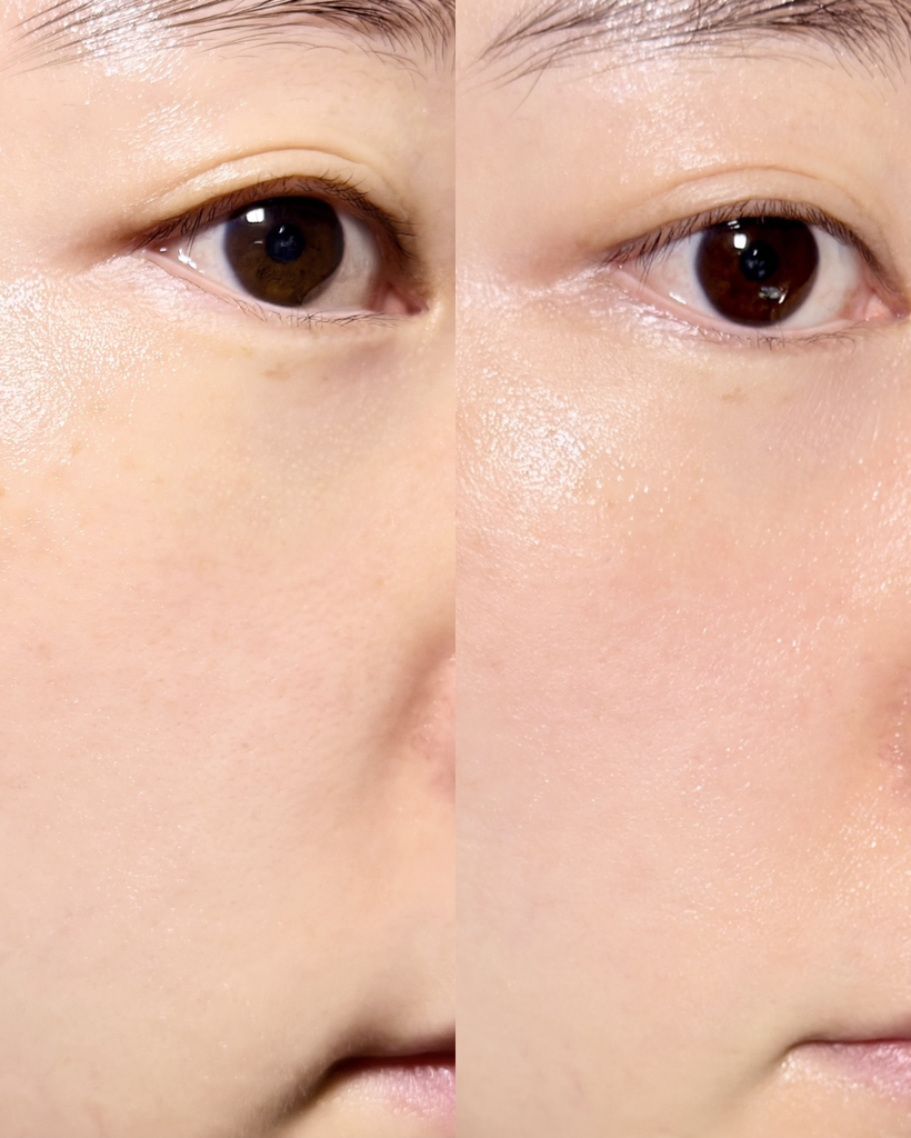 일소 (ilso) 이알 탄력 세럼 review image