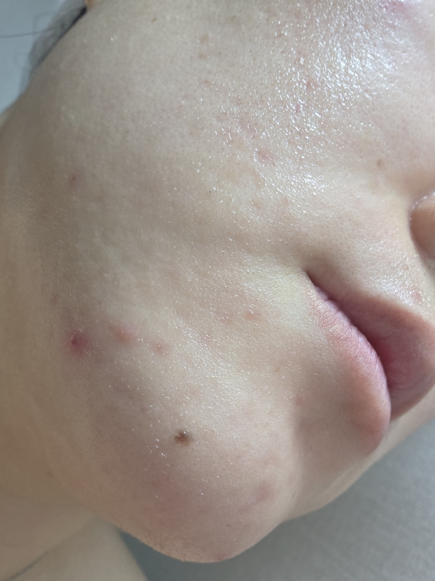 스타라이크 (starlike.) 로즈마리 68 스킨 바이옴 에센스 review image