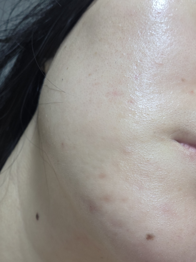 스타라이크 (starlike.) 로즈마리 68 스킨 바이옴 에센스 review image