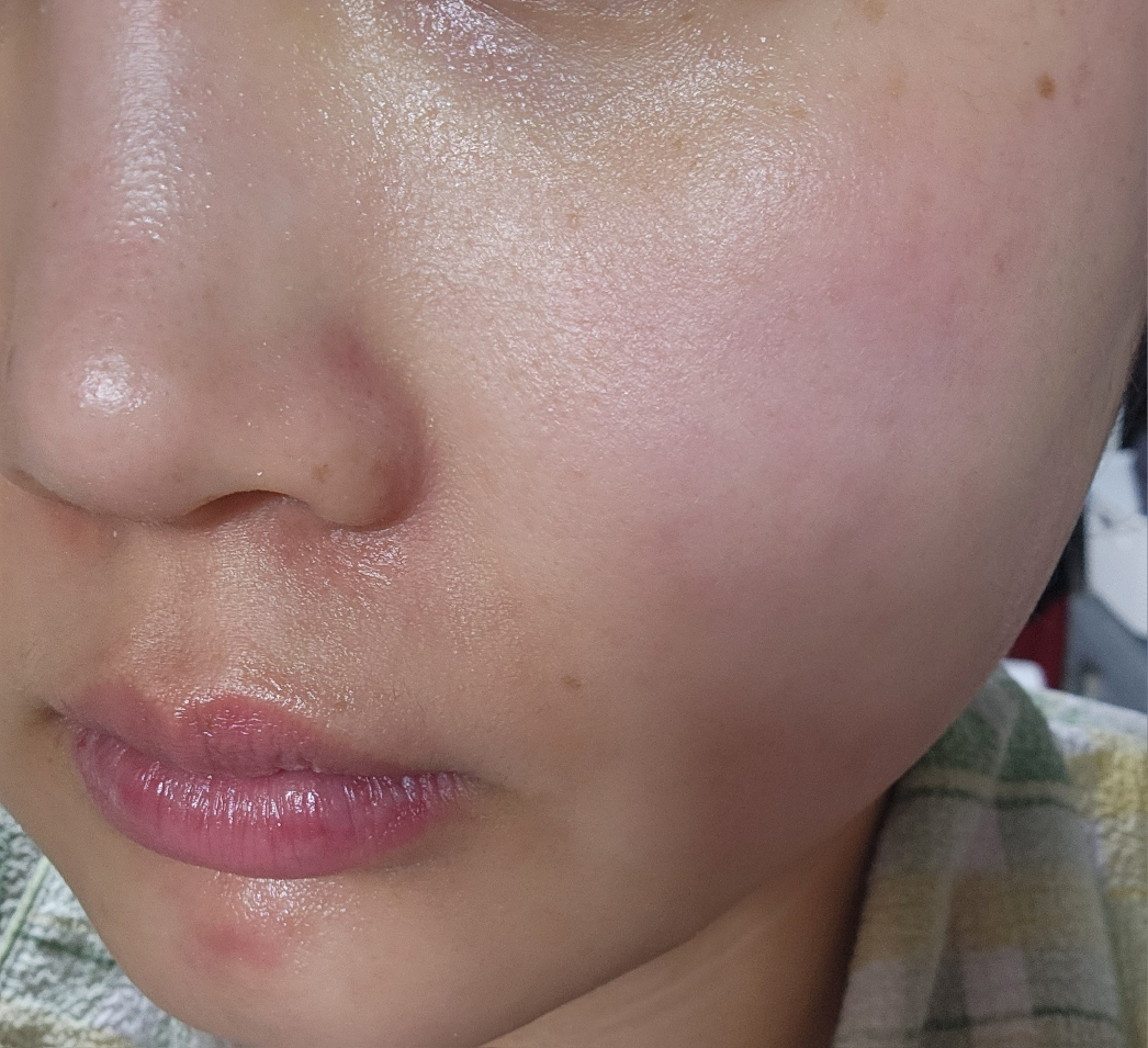 메디힐 (MEDIHEAL) 더마 모델링 팩 [티트리진정] review image