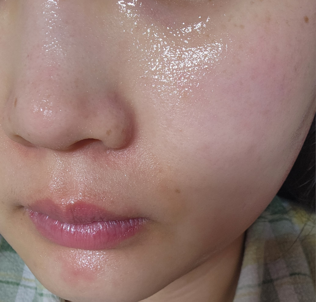 메디힐 (MEDIHEAL) 마데카소사이드 랩핑 세럼 마스크 [흔적 리페어] review image