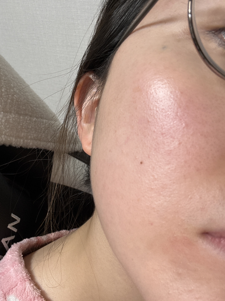 스타라이크 (starlike.) 아줄렌 듀얼 엑소좀 콜라겐 마스크 review image