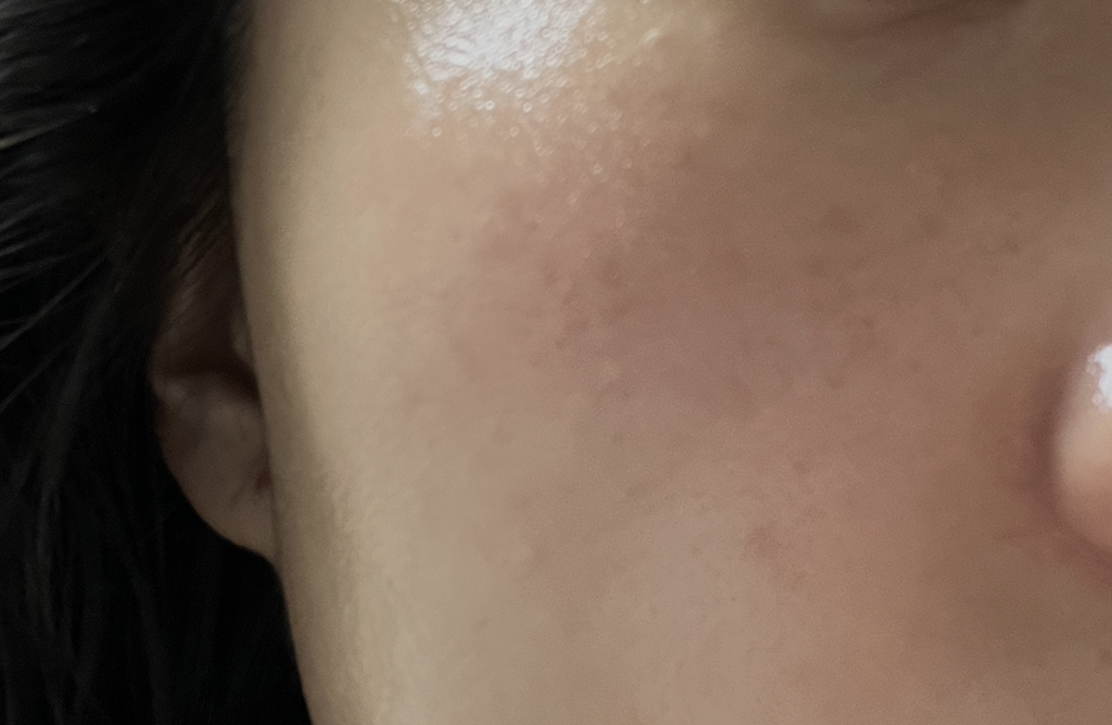 goodal Tangerine VitaC Blemish Care Serum Alpha review image