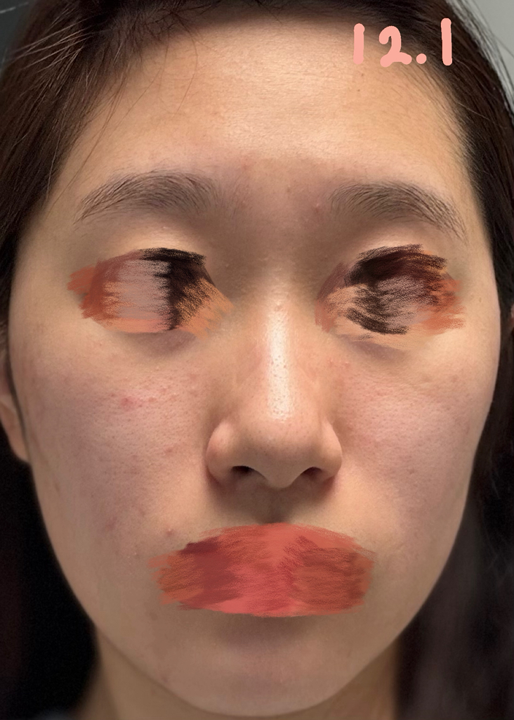 Torriden Suero Balancespool Sika Control review image