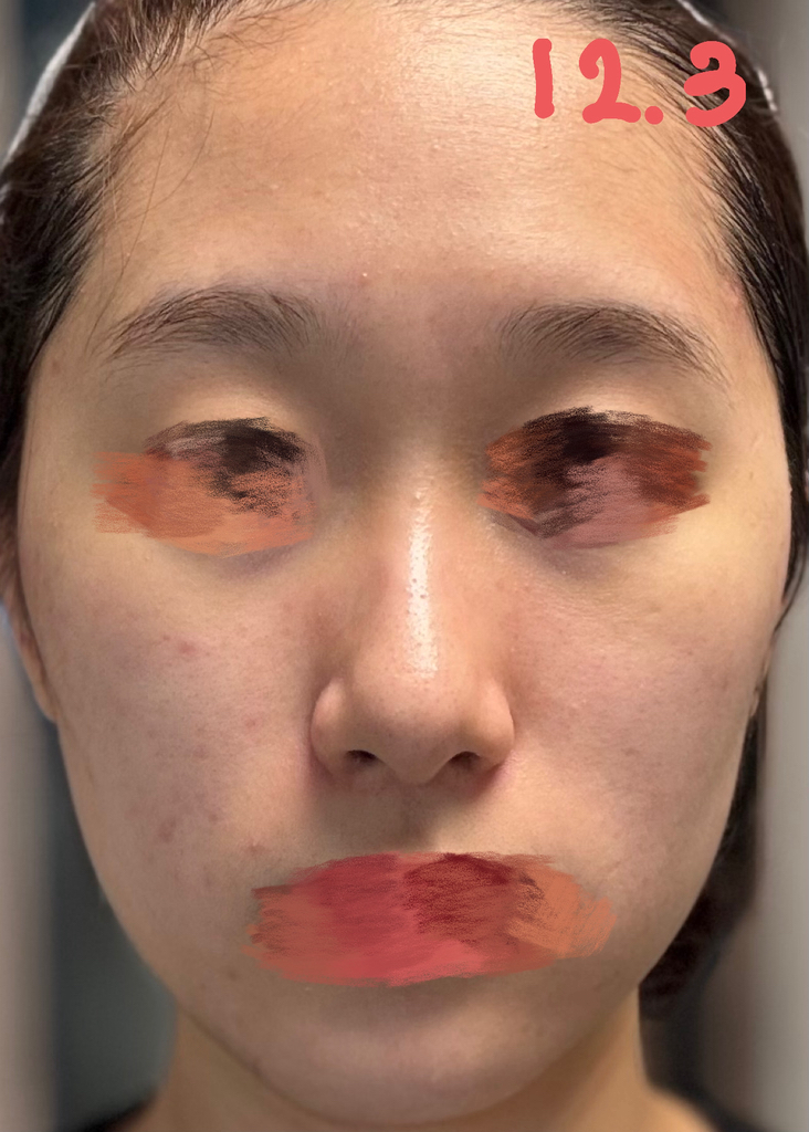 토리든 (Torriden) 밸런스풀 시카 컨트롤 세럼 review image