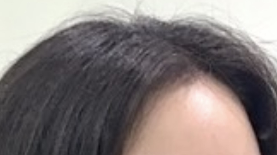 라운드랩 (ROUNDLAB) 자작나무 수분 패드 review image