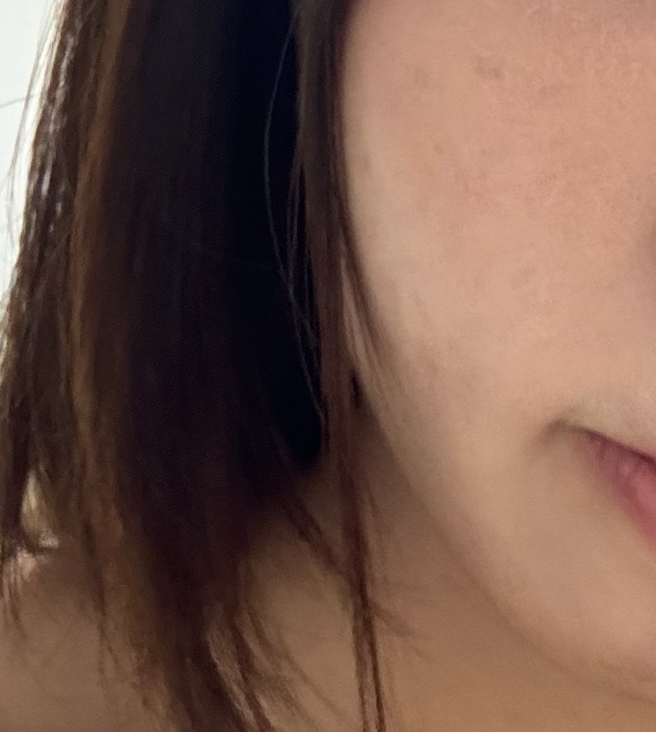 MEDIHEAL Mascarilla Esencial [Rosa PDRN Luz Cerradora de Poros] review image