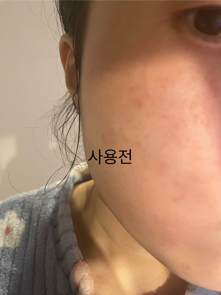 스타라이크 (starlike.) 로즈마리 68 스킨 바이옴 에센스 review image