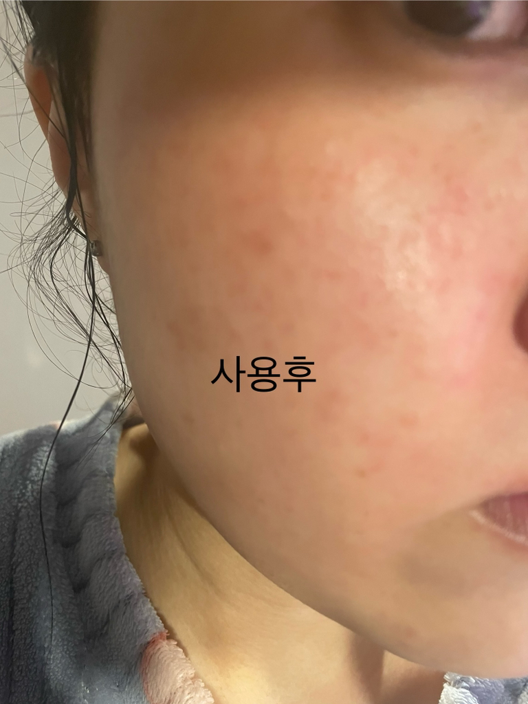 스타라이크 (starlike.) 로즈마리 68 스킨 바이옴 에센스 review image