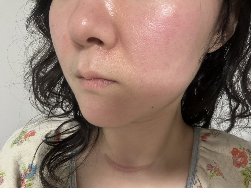 이니스프리 (INNISFREE) 레티놀 시카 흔적 앰플 review image