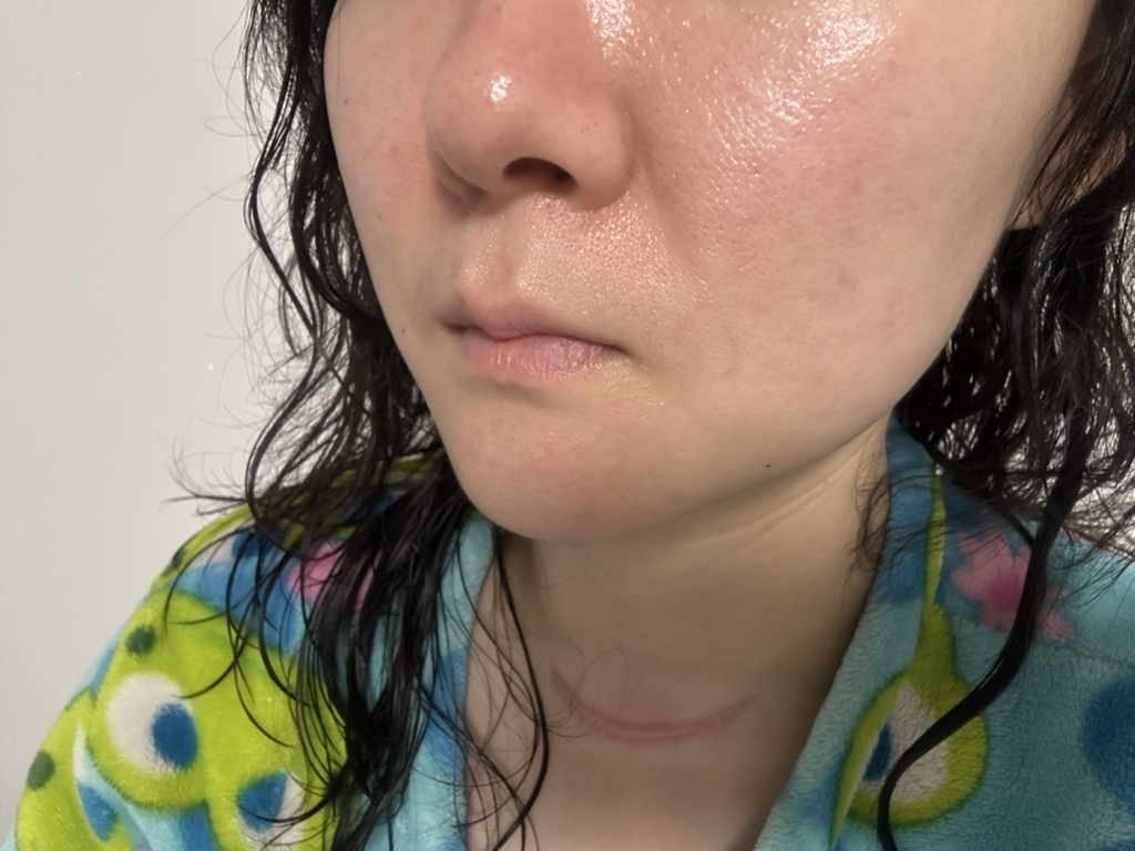 이니스프리 (INNISFREE) 레티놀 시카 흔적 앰플 review image