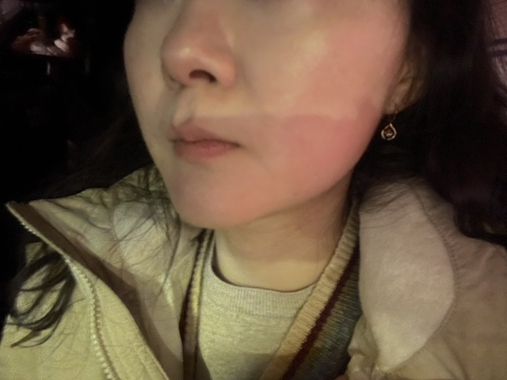 이니스프리 (INNISFREE) 레티놀 시카 흔적 앰플 review image