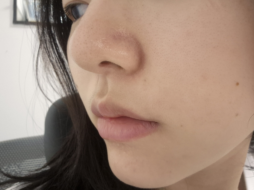 스타라이크 (starlike.) 로즈마리 68 스킨 바이옴 에센스 review image