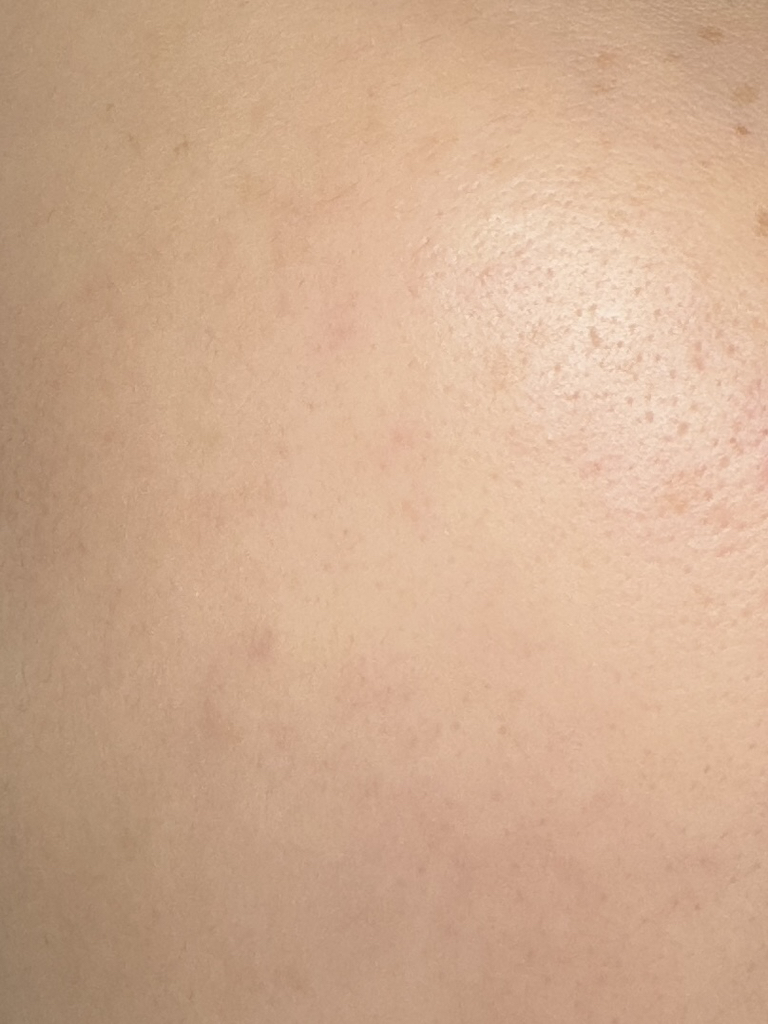 이니스프리 (INNISFREE) 레티놀 시카 흔적 앰플 review image