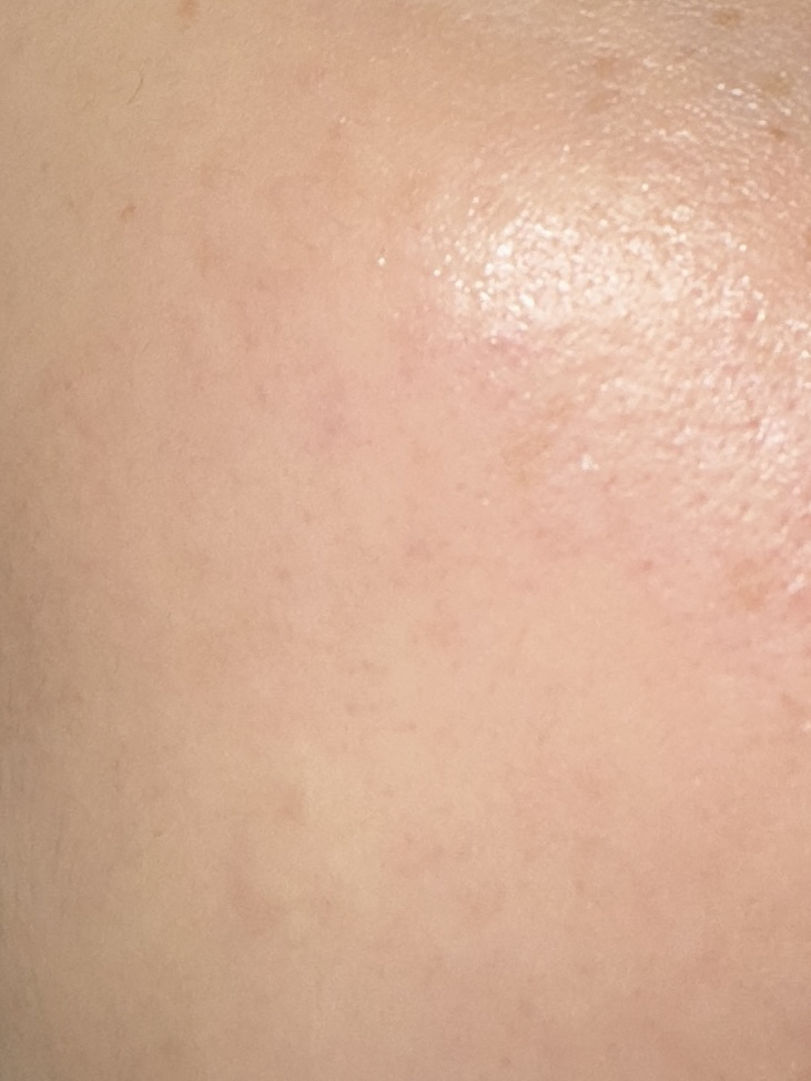 이니스프리 (INNISFREE) 레티놀 시카 흔적 앰플 review image