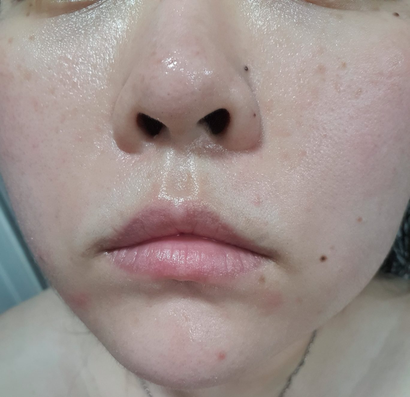 스타라이크 (starlike.) 로즈마리 68 스킨 바이옴 에센스 review image