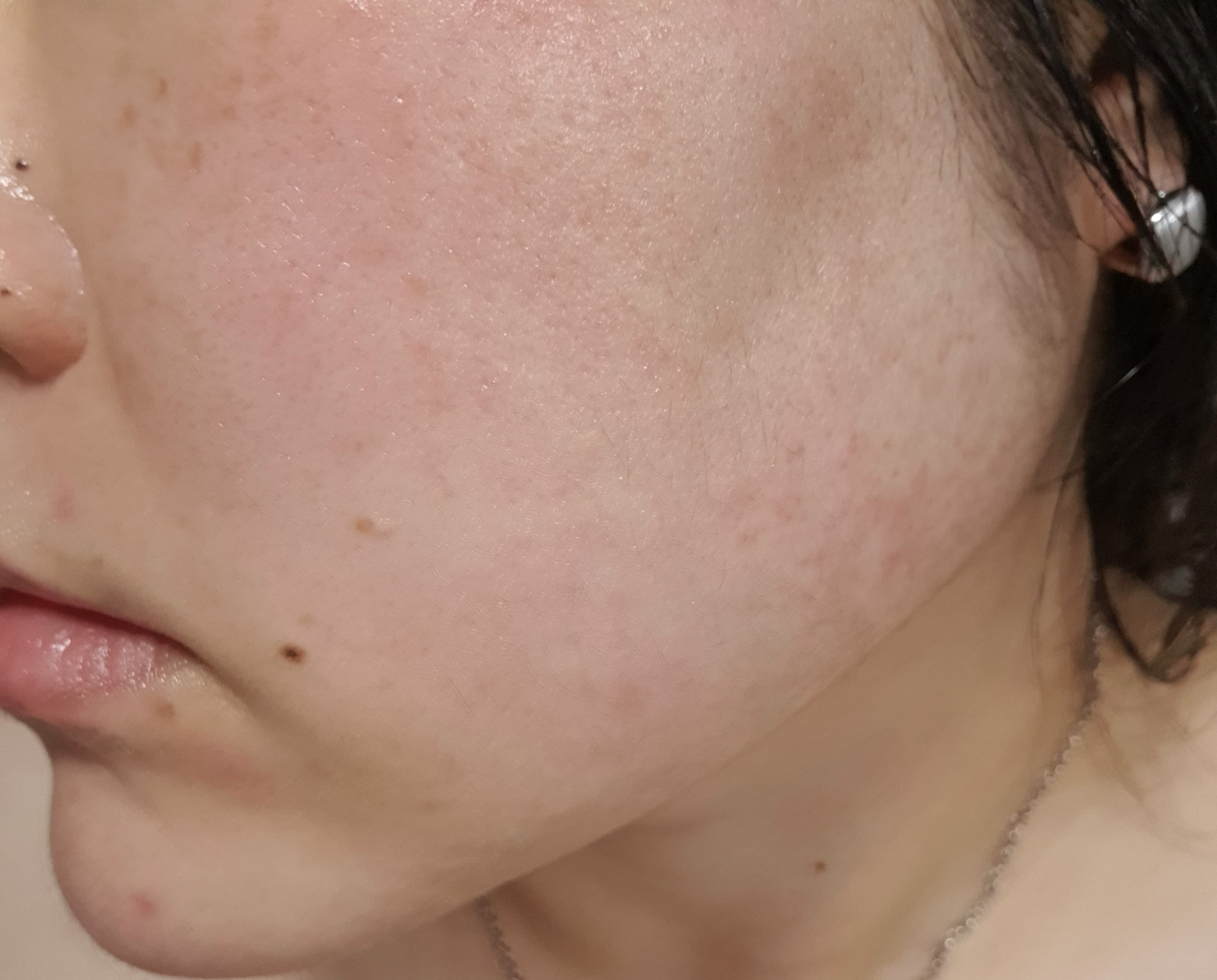 스타라이크 (starlike.) 로즈마리 68 스킨 바이옴 에센스 review image