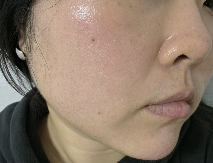 스타라이크 (starlike.) 로즈마리 68 스킨 바이옴 에센스 review image