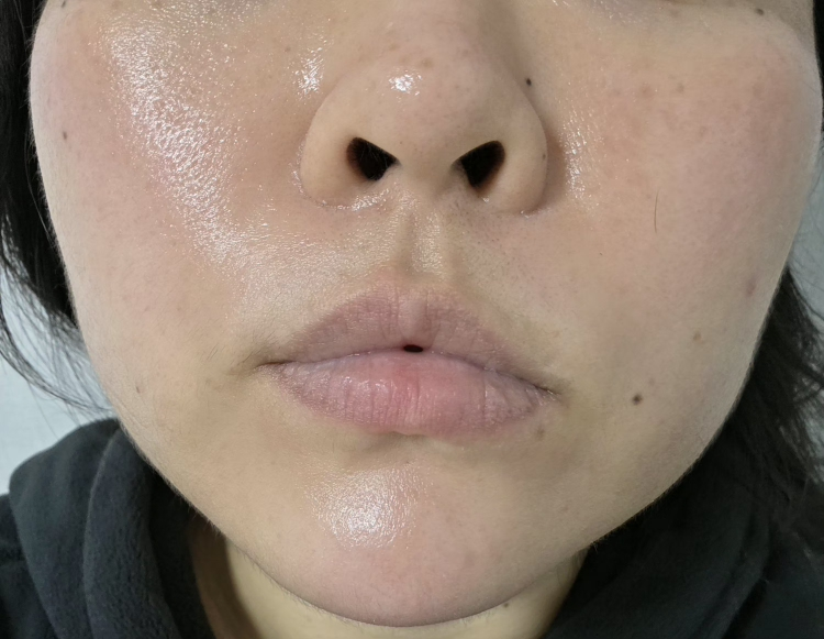 스타라이크 (starlike.) 로즈마리 68 스킨 바이옴 에센스 review image