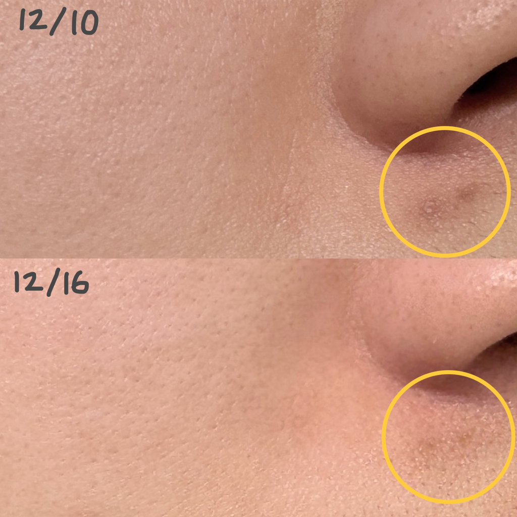 이니스프리 (INNISFREE) 레티놀 시카 흔적 앰플 review image