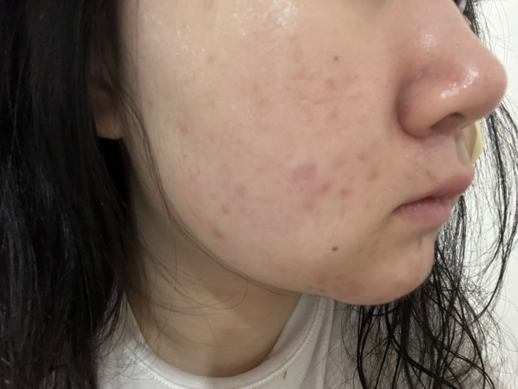 마일드랩 (mildlab) 센텔라 오인트 크림 review image