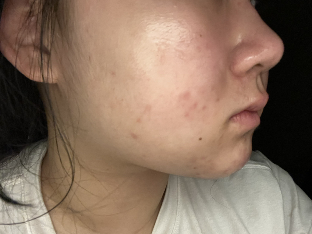 마일드랩 (mildlab) 센텔라 오인트 크림 review image