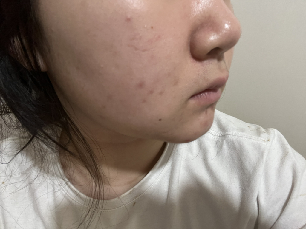 마일드랩 (mildlab) 센텔라 오인트 크림 review image