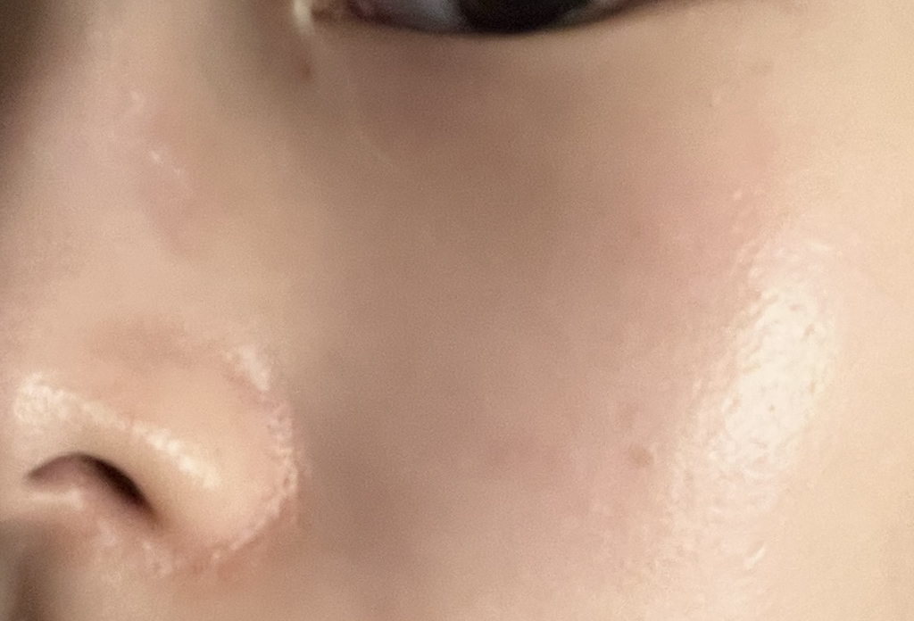 아누아 (Anua) PDRN 히알루론산 캡슐 100 세럼 review image