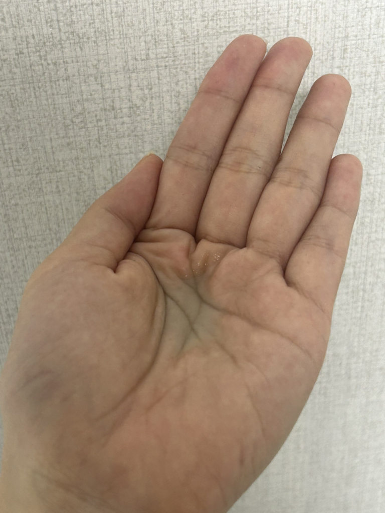 아누아 (Anua) PDRN 히알루론산 캡슐 100 세럼 review image