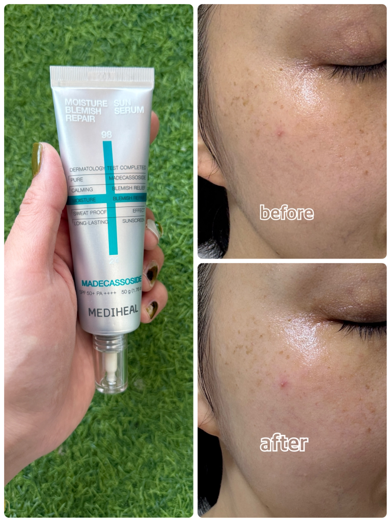 메디힐 (MEDIHEAL) 마데카소사이드 수분 선세럼 흔적 리페어 [SPF50+/PA++++] review image