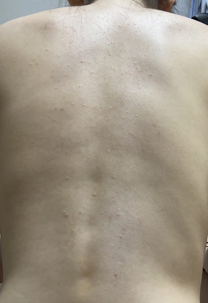 닥터올가 (Dr.Orga) 약산성 어성초 레드스팟 여드름 & 등드름 미스트 review image