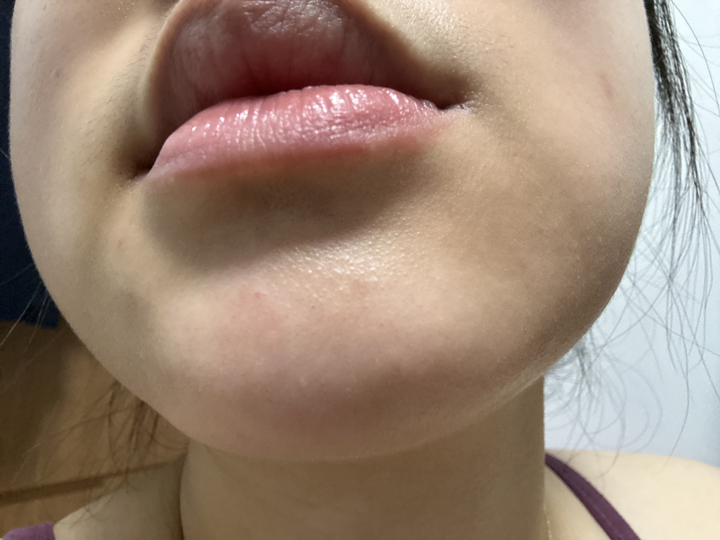 듀이트리 (DEWYTREE) AC 딥 흔적 진정 잡티 마스크 review image