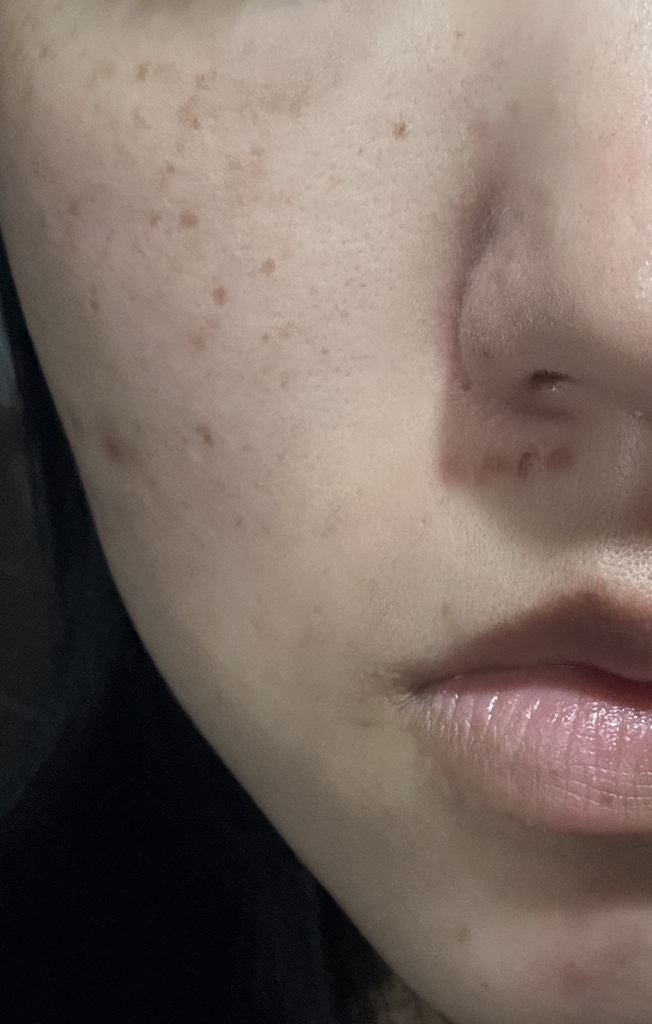 이즈앤트리 (IsNtree) 김 피디알엔 부스팅 글로우 패드 review image