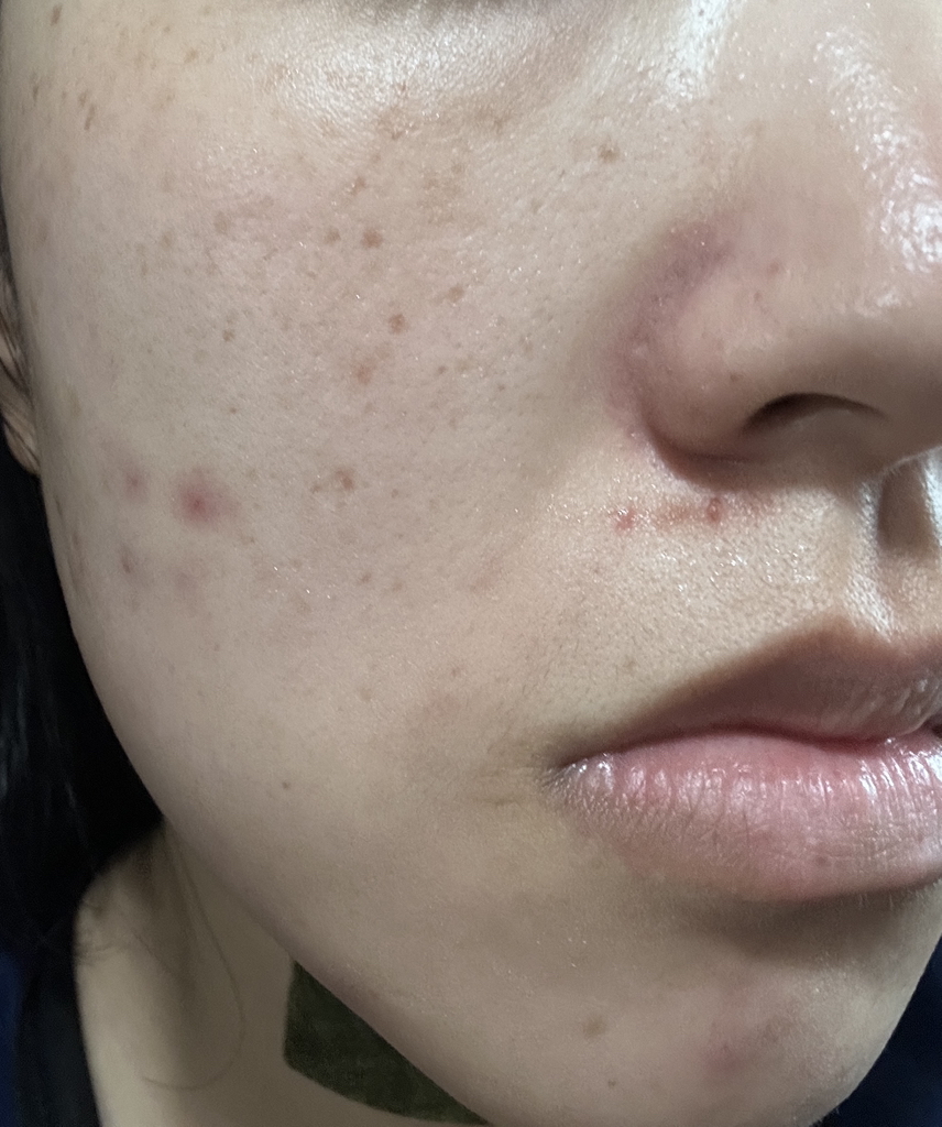 이즈앤트리 (IsNtree) 김 피디알엔 부스팅 글로우 패드 review image