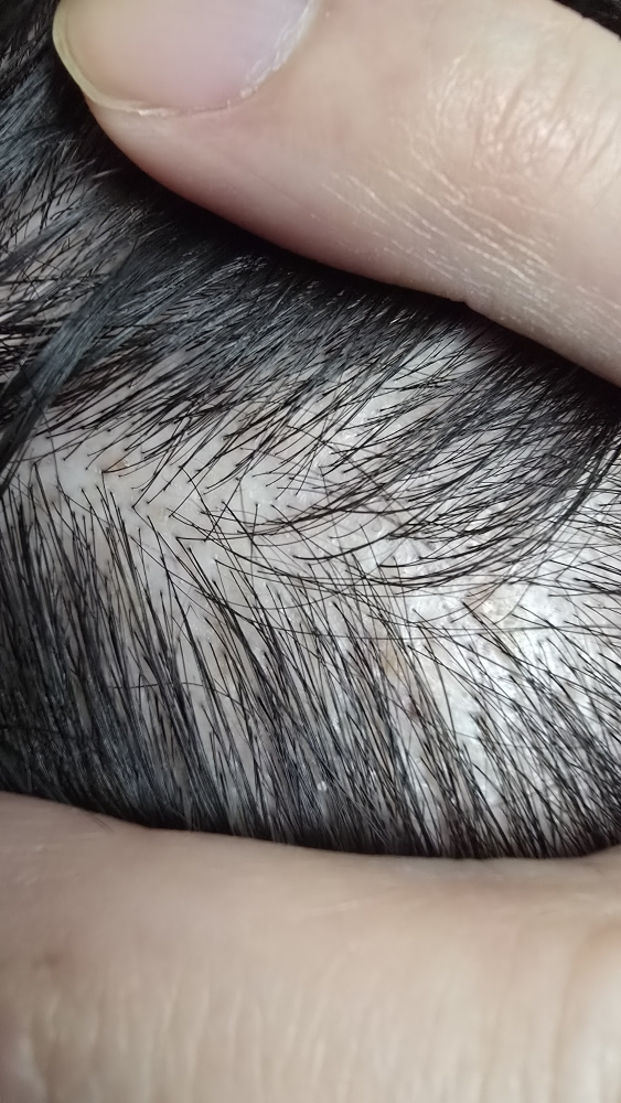 아르히 (Arhee) 스피큘 두피 앰플 review image