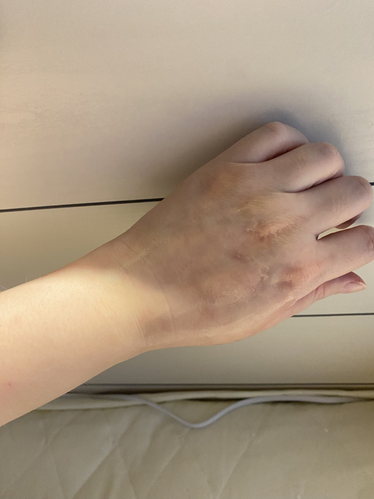 메디폴트 (MEDIFAULT) 피토젠필 앰플 review image