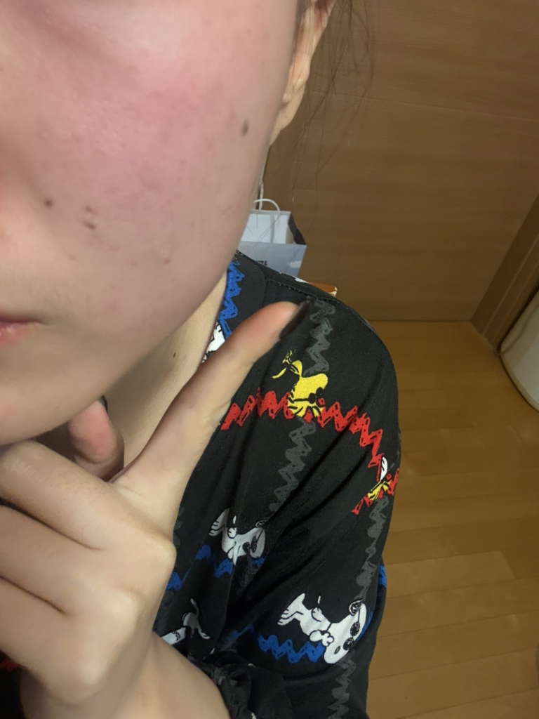 리쥬베닐 (Re-juvenil) 아바파하샴페인미스트앰플 review image