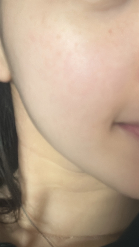 파티온 (FATION) 노스카나인 트러블 세럼 review image