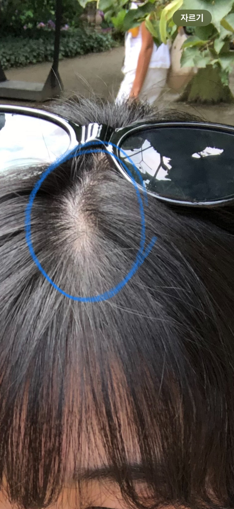 아르히 (Arhee) 스피큘 두피 앰플 review image