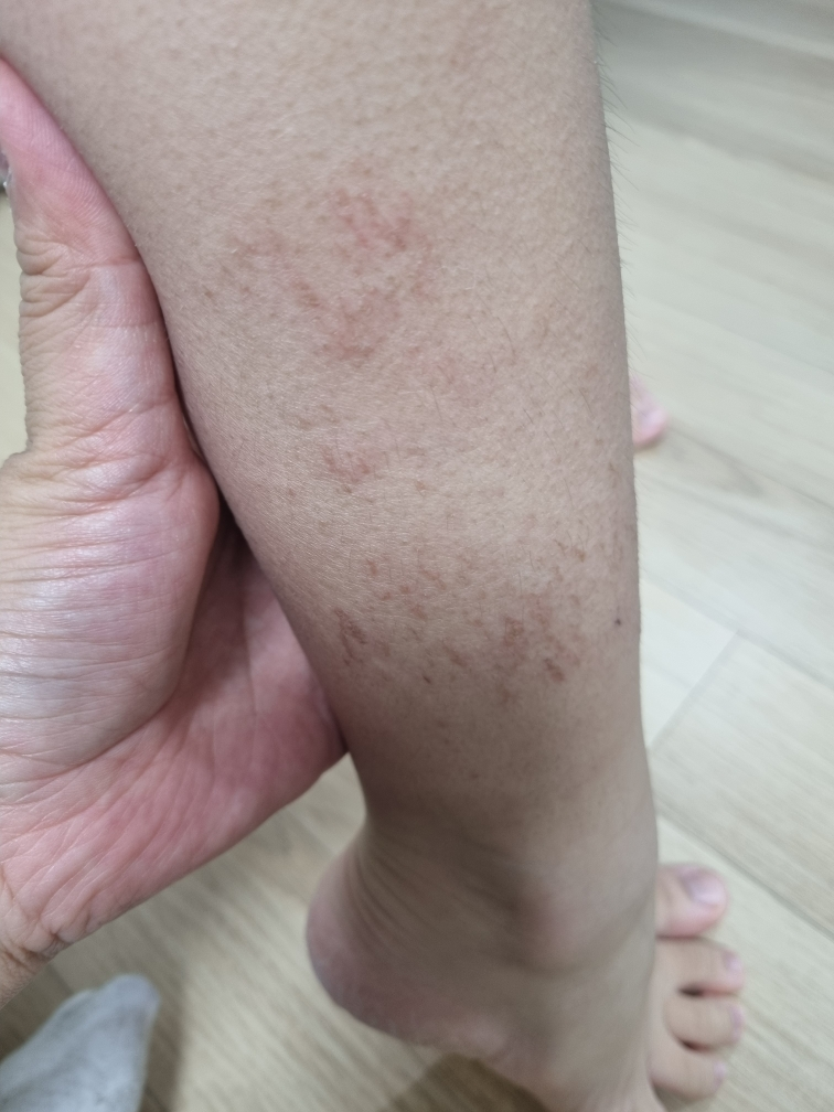 몽디에스 (mongdies) 아토 크림 review image