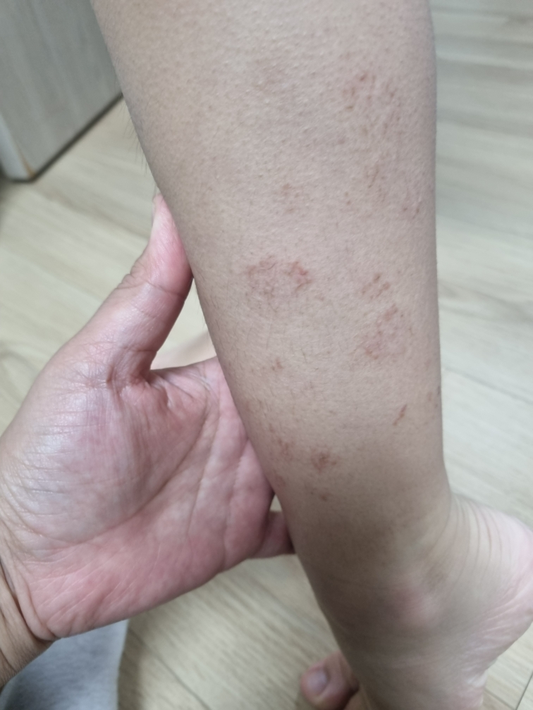 몽디에스 (mongdies) 아토 크림 review image