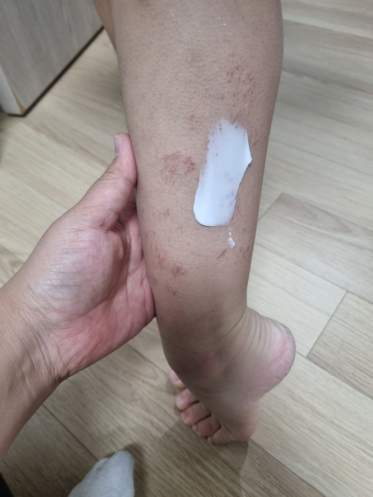 몽디에스 (mongdies) 아토 크림 review image